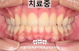 수술후