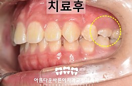 수술후