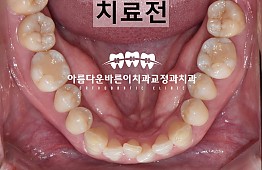 수술전