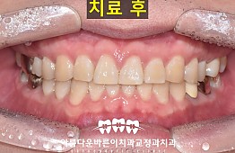 수술후