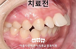 수술전