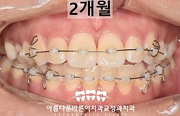 수술후