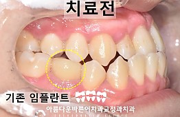 수술전