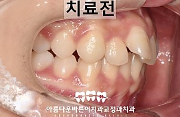 수술전