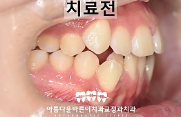 수술전