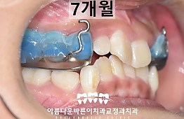 수술후