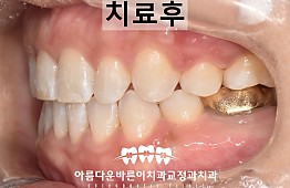 수술후