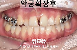 수술후