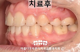 수술후