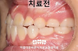 수술전