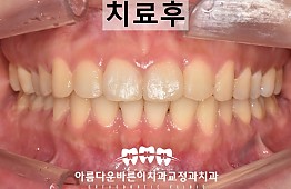 수술후