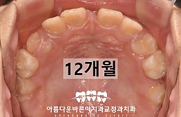 수술후