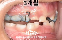 수술후