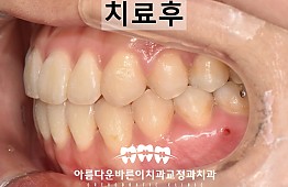 수술후