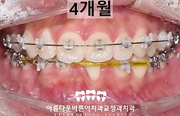 수술후