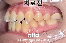 수술전