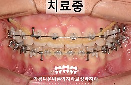수술후
