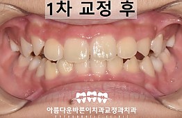 수술후