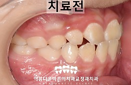 수술전