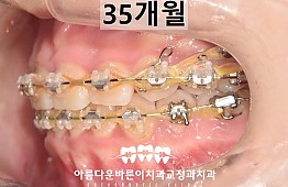 수술후