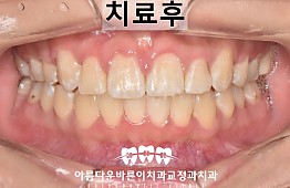 수술후