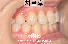 수술후