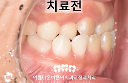 수술전