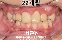 수술후