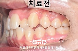 수술전