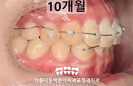 수술후