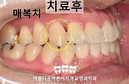 수술후