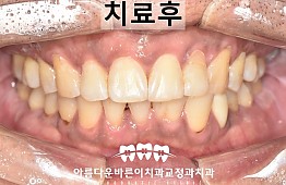 수술후