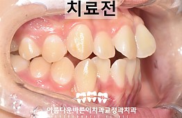 수술전