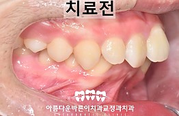 수술전