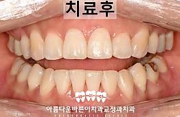 수술후