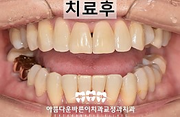 수술후