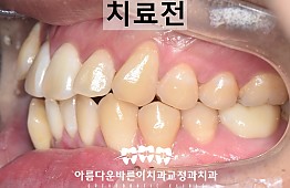 수술전