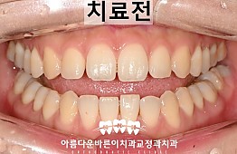 수술전