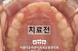수술전