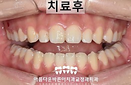 수술후