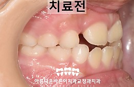 수술전