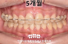 수술후