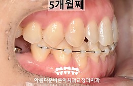 수술후