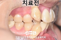 수술전