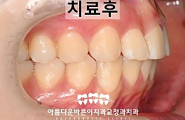 수술후