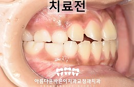 수술전