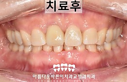 수술후