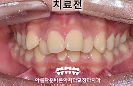 수술전