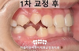 수술후