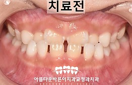 수술전